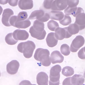 Pk_rings_thin_NY5.jpg Figure E: Ring-form trophozoites of <em>P. knowlesi</em> in a Giemsa-stained thin blood smear from a human patient that traveled to the Philippines. Image courtesy of the Wadsworth Center, New York State Department of Health.