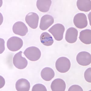 Pk_troph_thin_NY1.jpg Figure A: Band-form trophozoite of <em>P. knowlesi</em> in a Giemsa-stained thin blood smear from a human patient that traveled to the Philippines. Image courtesy of the Wadsworth Center, New York State Department of Health.