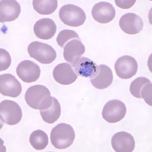 Pk_gametocyte_thin_NY1.jpg Figure A: Gametocyte of <em>P. knowlesi</em> in a Giemsa-stained thin blood smear from a patient that traveled to the Philippines. Image courtesy of the Wadsworth Center, New York State Department of Health.