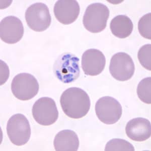 Pk_schizont_thin_NY1.jpg Figure A: Mature schizont in a Giemsa-stained thin blood smear from a patient that traveled to the Philippines.Images courtesy of the Wadsworth Center, New York State Department of Health.