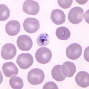 Pk_schizont_thin_NY2.jpg Figure B: Mature schizont in a Giemsa-stained thin blood smear from a patient that traveled to the Philippines. Note also a ring-form trophozoite to the right of the schizont in this figure. Images courtesy of the Wadsworth Center, New York State Department of Health.