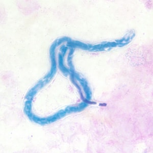 M_perstans_thick_BAM3.jpg Figure C: Microfilaria of <em>M. perstans</em> in a thick blood smear stained with Giemsa, from a patient from Cameroon.