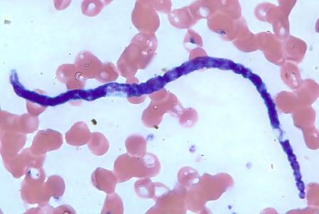 M_perstans_thin_BAM1.jpg Figure D: Microfilaria of <em>M. perstans</em> in a thin blood smear from the same specimen as Figures A-C.