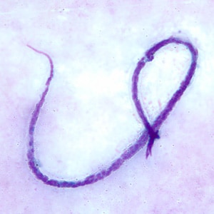 M_ozzardi_BAM3.jpg Figure C: Microfilaria of <em>M. ozzardi</em> in a thick blood smears, stained with Giemsa.