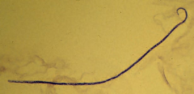 M_streptocerca_2x2.jpg Figure A: Microfilaria of <em>M. streptocerca</em>, fixed in 2% formalin and stained with hematoxylin.
