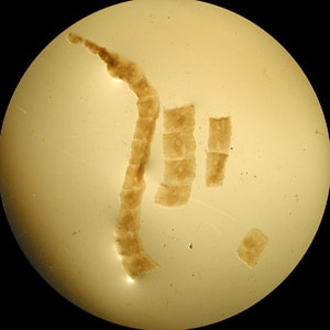 Mesocestoides_dog_AZPHL_A.jpg Figure A: Proglottids of <em>Mesocestoides</em> sp., collected from the stool of a dog.