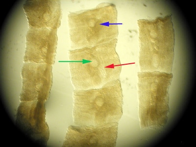 Mesocestoides_dog_AZPHL_B.jpg Figure B: Higher magnification of the proglottids in Figure A, showing the uterus (red arrow), ovary (blue arrow) and parauterine organ (green arrow).