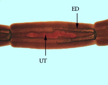 Mesocestoides_proglottid_BAM1.jpg Figure C