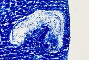 A Figure A: Tetrathyridium of <em>Mesocestoides</em> sp. in the liver of a laboratory-infected mouse, Giemsa stain. 100x magnification.