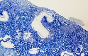A Figure D: Multiple tetrathyridia visible in a liver section from an experimentally-infected mouse. 40x magnification.