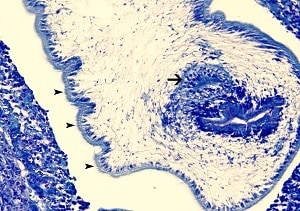 C Figure C