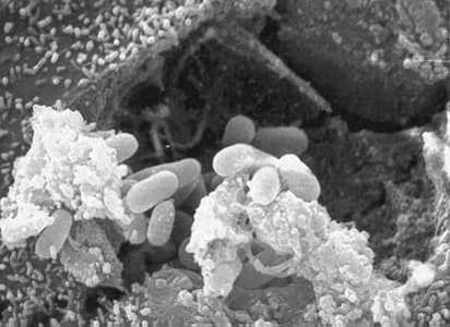E_hellum_SEM_2012.jpg Figure A: Scanning electron micrograph showing an eukaryotic cell bursting and releasing spores of <em>Encephalitozoon hellem</em> to the extracellular medium.