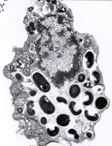 Eintestinalis_spores_EM_2012.jpg Figure B: Electron micrograph of an eukaryotic cell with <em>Encephalitozoon intestinalis</em> spores and developing forms inside a septated parasitophorous vacuole. The vacuole is a characteristic feature of this microsporidian species.
