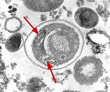 msp_EM_arrows_2012.jpg Figure C: Electron micrograph of an <em>Enterocytozoon bieneusi</em> spore. Arrows indicate the double rows of polar tubule coils in cross section which characterize a mature E. bieneusi spore.