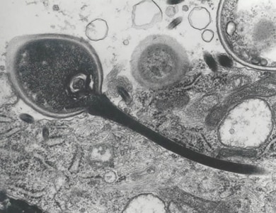 msp_tubule_EM2_2012.jpg Figure F: Transmission electron micrograph of a microsporidian spore with an extruded polar tubule inserted into a eukaryotic cell. The spore injects the infective sporoplasms through its polar tubule. Figure courtesy of Dr. Massimo Scaglia, Laboratory of Clinical Parasitology, Institute of Infectious Diseases, University-IRCCS San Matteo, Pavia, Italy.