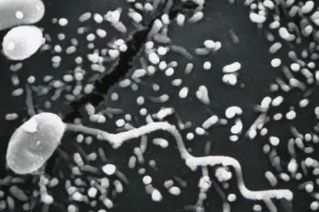 msp_tubule_EM_2012.jpg Figure E: Scanning electron micrograph of a microsporidian spore with an extruded polar tubule inserted into a eukaryotic cell. The spore injects the infective sporoplasms through its polar tubule.