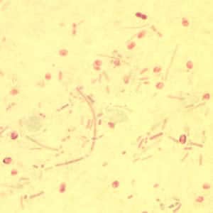 Ebieneusi_spores_chromo2012.jpg Figure D: <em>Enterocytozoon bieneusi</em> spores stained with Chromotrope 2R.