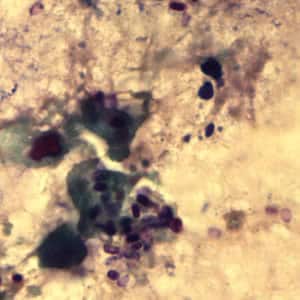 Ecuniculi_spores_gramchromo2_2012.jpg Figure B: <em>Encephalitozoon cuniculi</em> spores stained with Gram Chromotrope.