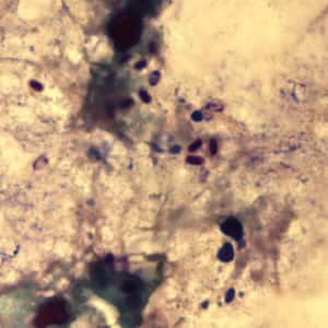 Ecuniculi_spores_gramchromo3_2012.jpg Figure C: <em>Encephalitozoon cuniculi</em> spores stained with Gram Chromotrope.