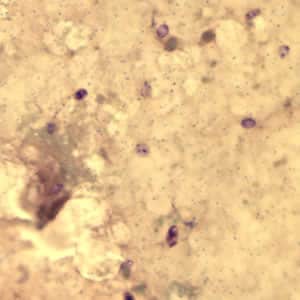 Ecuniculi_spores_gramchromo_2012.jpg Figure A: <em>Encephalitozoon cuniculi</em> spores stained with Gram Chromotrope.