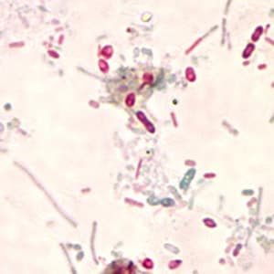 Microsporidia_2012.jpg Figure E: Unidentified microsporidia stained with Chromotrope 2R.