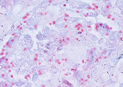 Ec_MAYO_KidneyTrichrome.jpg Figure D: Spores of <em>E. cuniculi</em> in a kidney biopsy specimen stained with Ryan's modified trichrome.
