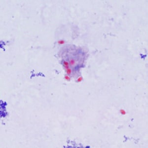 Ec_MAYO_Trichrome1.jpg Figure A: Spores of <em>E. cuniculi</em> from urine stained with Ryan's modified trichrome (Trichrome blue).