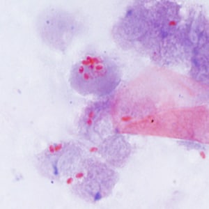 Ec_MAYO_Trichrome2.jpg Figure B: Spores of <em>E. cuniculi</em> from urine stained with Ryan's modified trichrome (Trichrome blue).