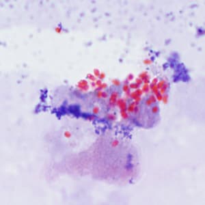 Ec_MAYO_Trichrome3.jpg Figure C: Spores of <em>E. cuniculi</em> from urine stained with Ryan's modified trichrome.