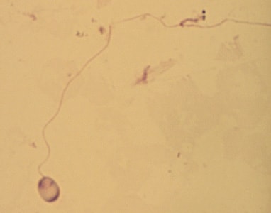 msp_Sweden2.jpg Figure B: A single microsporidia spore from the same case as Figure A, stained with Giemsa. In this image, the polar tubule has been extruded.
