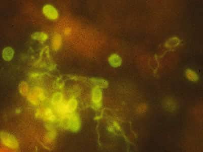 Ehellem_spores_IFA_2012.jpg Figure A: Monoclonal antibody-based immunofluorescence identification of <em>Encephalitozoon hellem</em>.