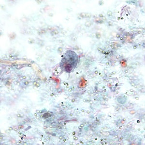 R_intestinalis_troph_BAM1.jpg Figure A