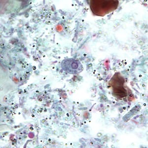 R_intestinalis_cyst_BAM3.jpg Figure B