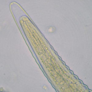 Figure B: Higher-magnification of the anterior end of the specimen in Figure A. Note the long cephalic space.