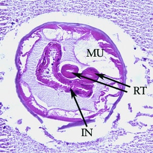 Figure B: Higher magnification (200x) of the specimen in Figure A. Note the large, platymyarian muscle cells (MU), intestine with brush border (IN), and paired reproductive tubes (RT).
