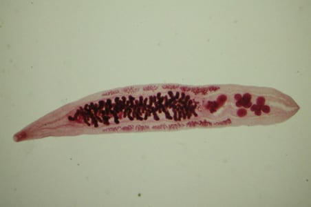 Figure B: Adult of <em>O. viverrini</em>. Image courtesy of the Web Atlas of Medical Parasitology and the Korean Society for Parasitology.