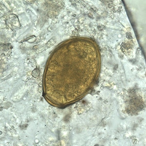 P_westermani_egg_wtmt_BAM1.jpg Figure B: Egg of <em>P. westermani</em> in an unstained wet mount.
