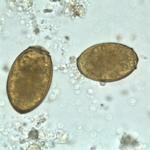 P_westermani_egg_wtmt_BAM2.jpg Figure C: Eggs of <em>P. westermani</em> in an unstained wet mount.