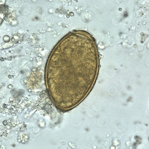 P_westermani_egg_wtmt_BAM3.jpg Figure D: Egg of <em>P. westermani</em> in an unstained wet mount.