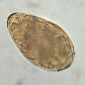 Paragonimus_egg_wtmt.jpg Figure A: Egg of <em>P. westermani</em> in an unstained wet mount.