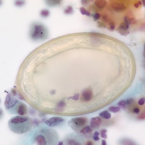 P_kellicottii_BAL1000x_Prokop.jpg Figure E: Higher magnification (1000x, oil) of the specimen in Figures C and D. Image courtesy of Dr. Gary Procop.
