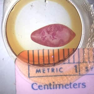 Paragonimus_adult_hematoxylin.jpg Figure A: Adult of <em>P. westermani</em>.