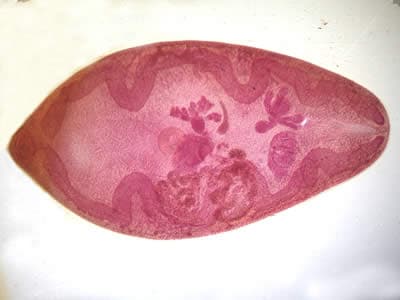 Paragonimus_adult_hematoxylin2.jpg Figure B: Higher magnification of the adult fluke seen in Figure A.