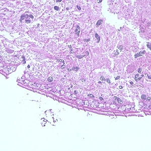 Paragonimus_cuticle_close-up.jpg Figure D: Higher magnification of Figure C, showing a close-up of the cuticle.
