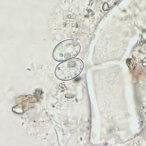 Figure A: Sporulated oocyst of <em>Sarcocystis</em> sp. in an unstained wet mount, magnification 400x.