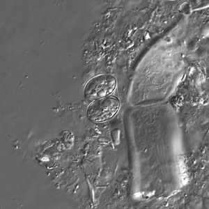 Figure A: Sporulated oocyst of <em>Sarcocystis</em> sp. in a wet mount viewed under differential interference contrast (DIC) microscopy, magnification 400x.