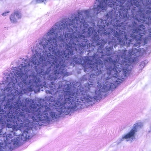 Figure F: Higher magnification (1000x) of the <em>Sarcocystis</em> in Figure E, showing many bradyzoites.