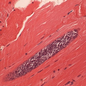 Figure D: Higher magnification of one of the <em>Sarcocystis</em> in Figure C, showing many bradyzoites.