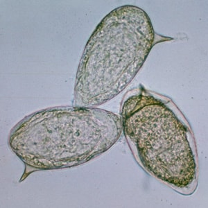 Figure E: Eggs of <em>S. mansoni</em> in an unstained wet mount.