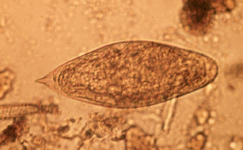 Figure A: Egg of <em>S. intercalatum</em> in a wet mount.
